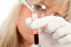 В каких случаях акушер-гинеколог, терапевт или онколог назначает анализ крови на гормоны?